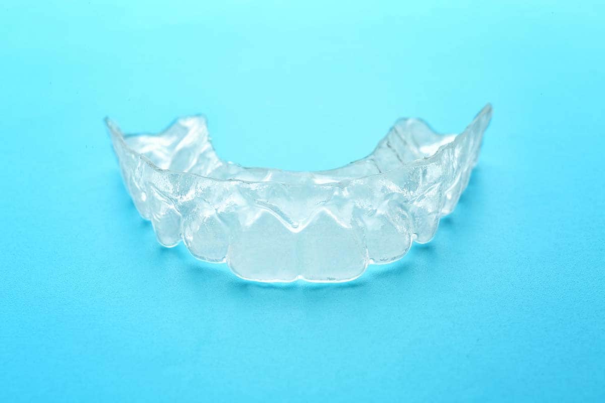 example of what are dental nightguards