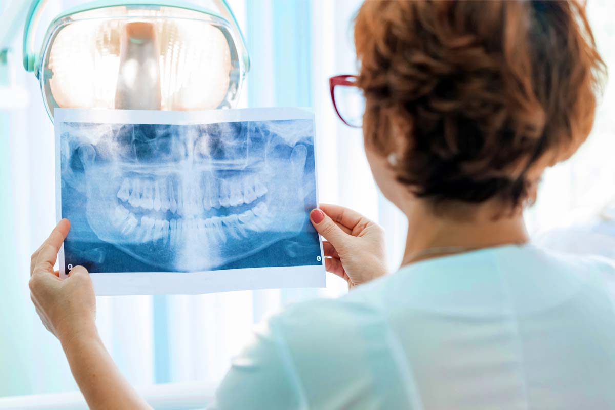 patient looking at teeth chart wondering if they need an endodontist vs. dentist