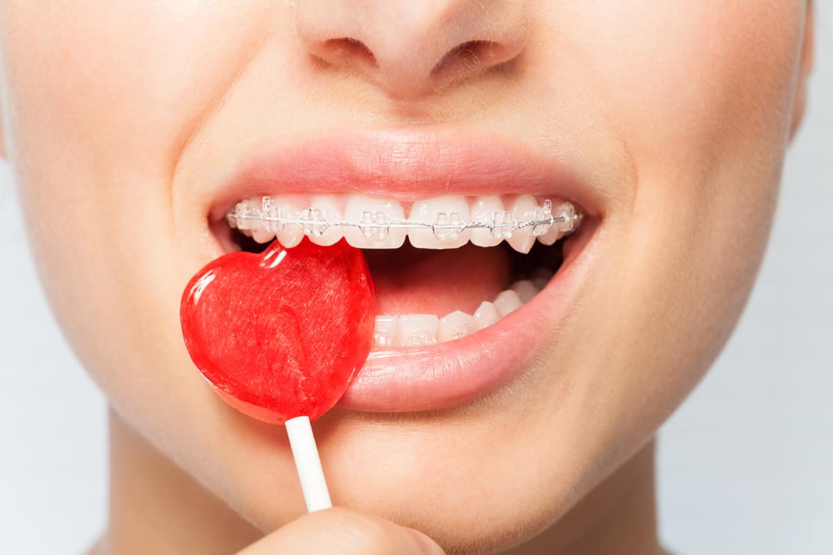 Woman eating candy with braces.