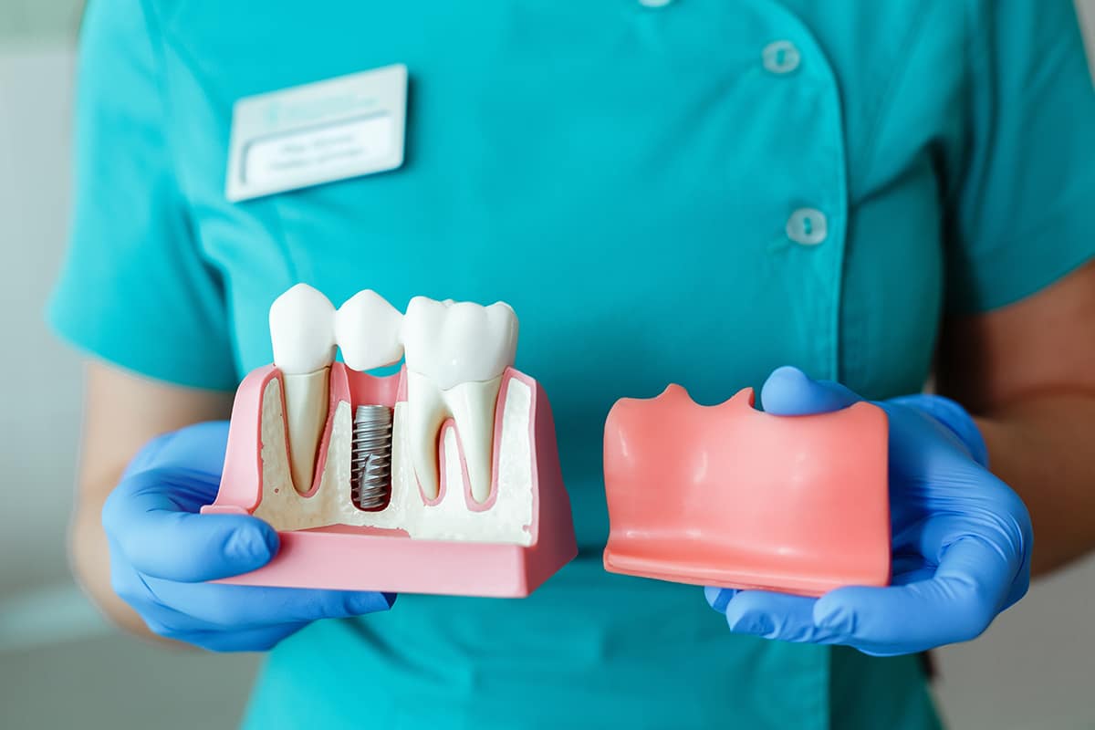 Pros and cons of dental implants