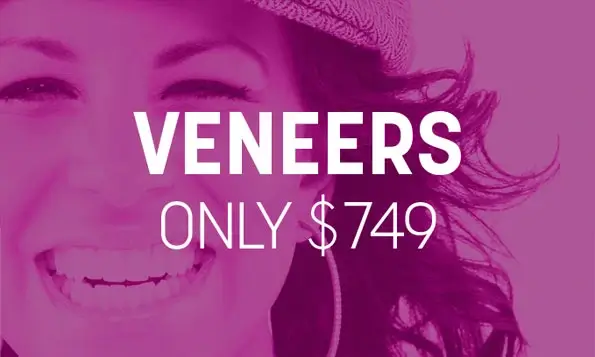 749 veneers