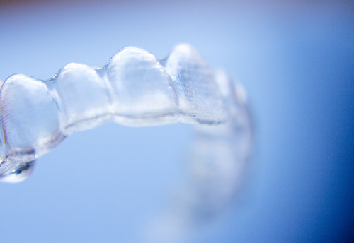 clear aligners