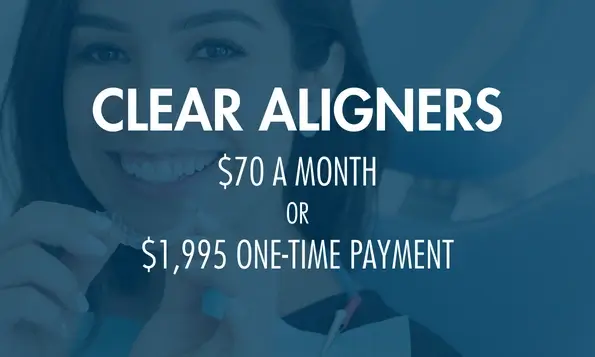 clear aligners