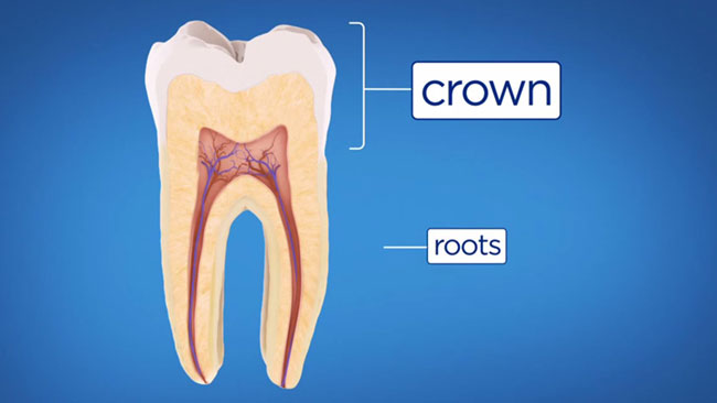 root canal therapy