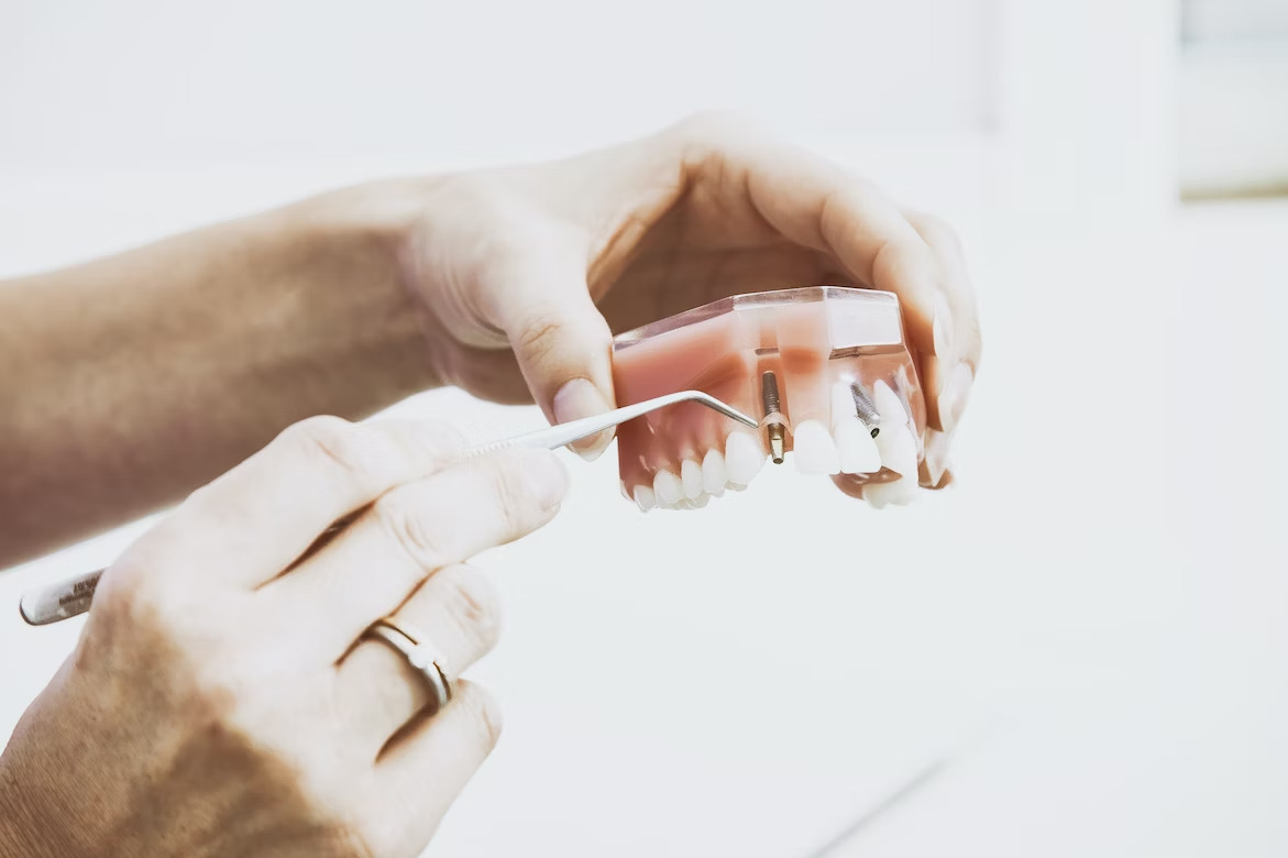 dental professional showing how the titanium post for dental implant is installed into the jaw