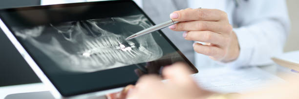 image  a dental professional explaining the result of a patient's dental X-ray result