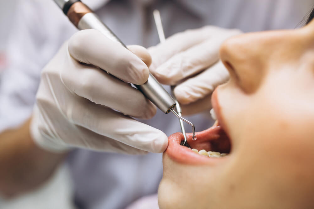 close-up shot of a person's mouth during a dental procedure