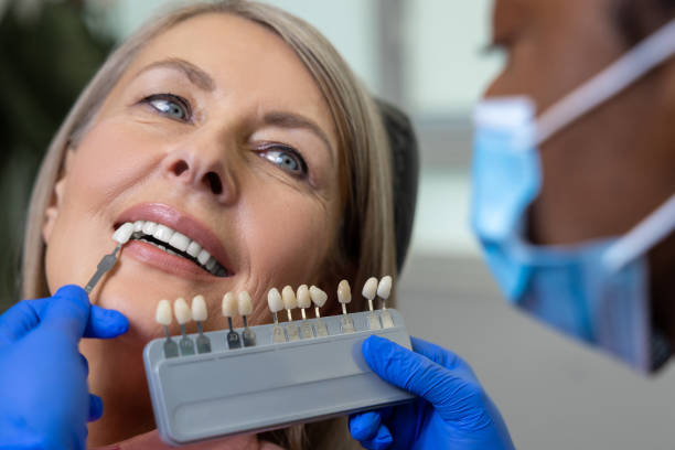 photo of a woman during veneer shade selection