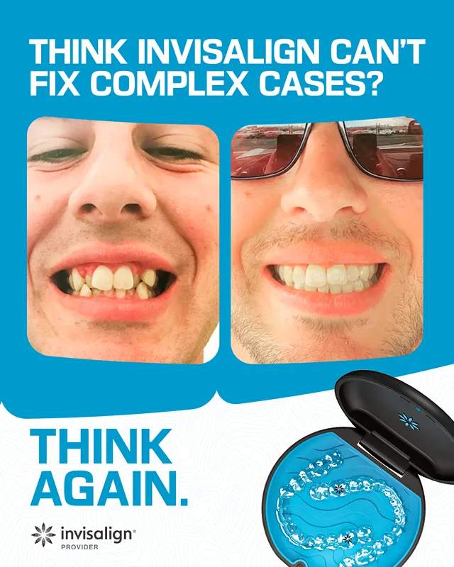 complexcases male 4x5