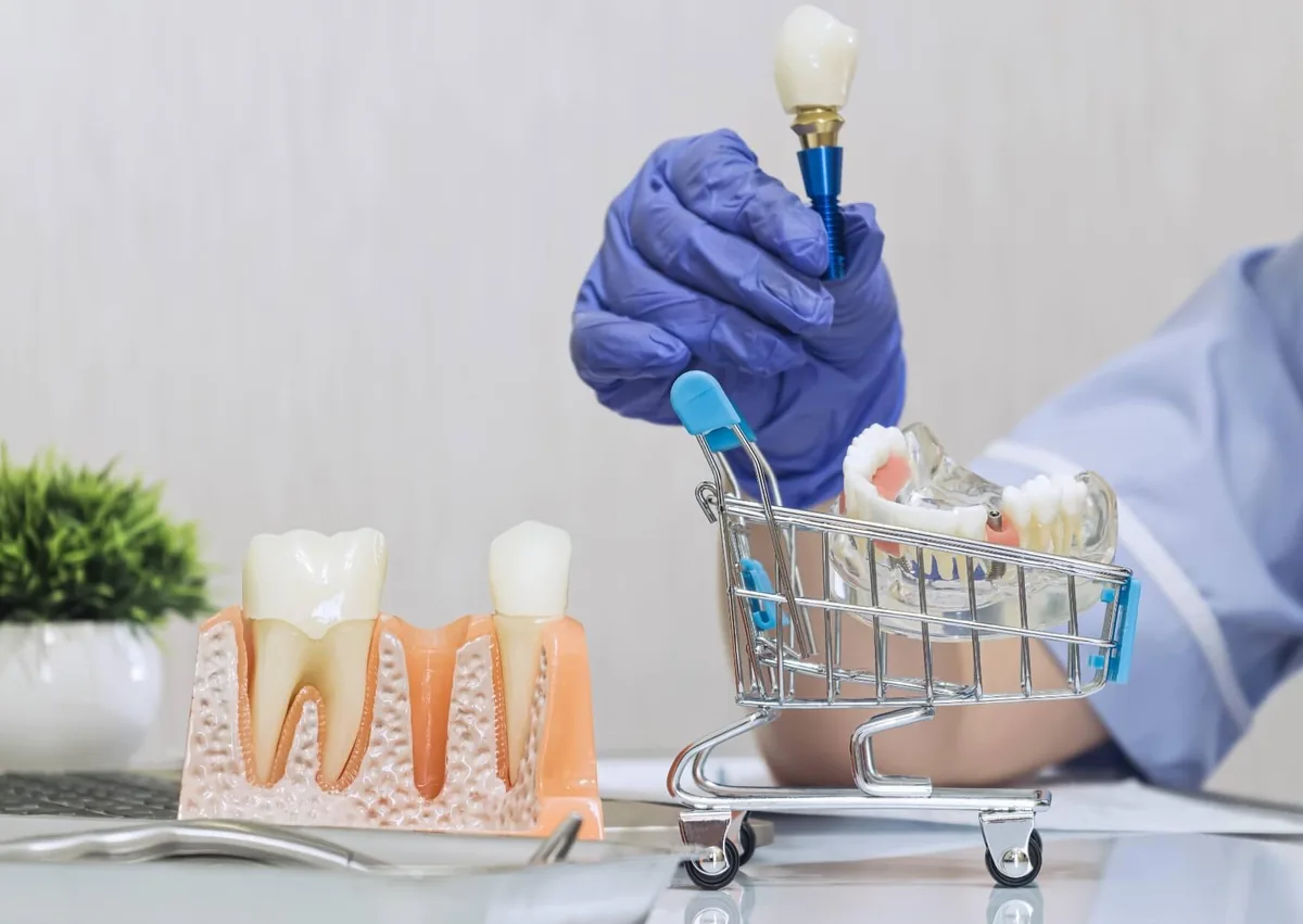 Dental implant models with a miniature shopping cart, representing affordable dental implants and tooth replacement options.