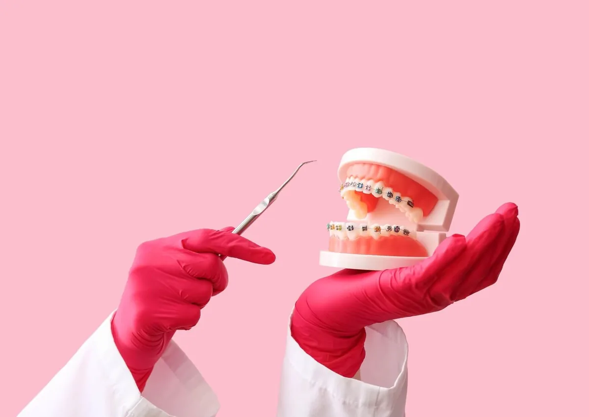 Dental model with metal braces held by a dental professional, illustrating orthodontic treatment options and braces cost.